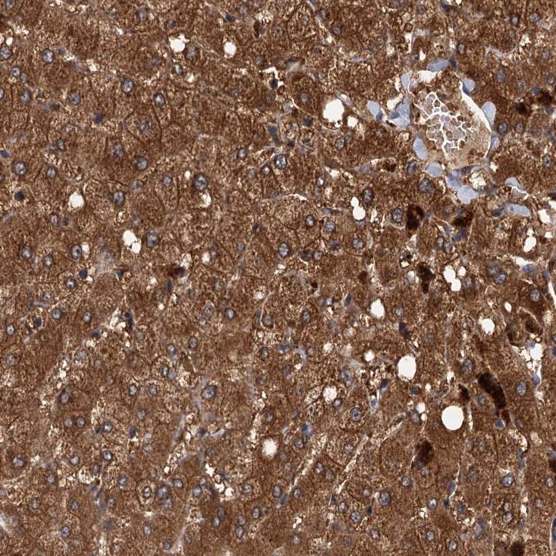 Atlas Antibodies Anti-RSAD2 Antibody