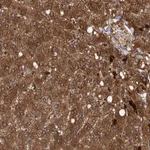 Atlas Antibodies Anti-RSAD2 Antibody