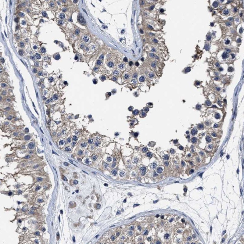 Atlas Antibodies Anti-RSBN1L Antibody