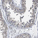Atlas Antibodies Anti-RSBN1L Antibody