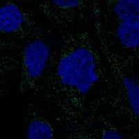 Atlas Antibodies Anti-RSAD1 Antibody