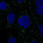 Atlas Antibodies Anti-RSAD1 Antibody