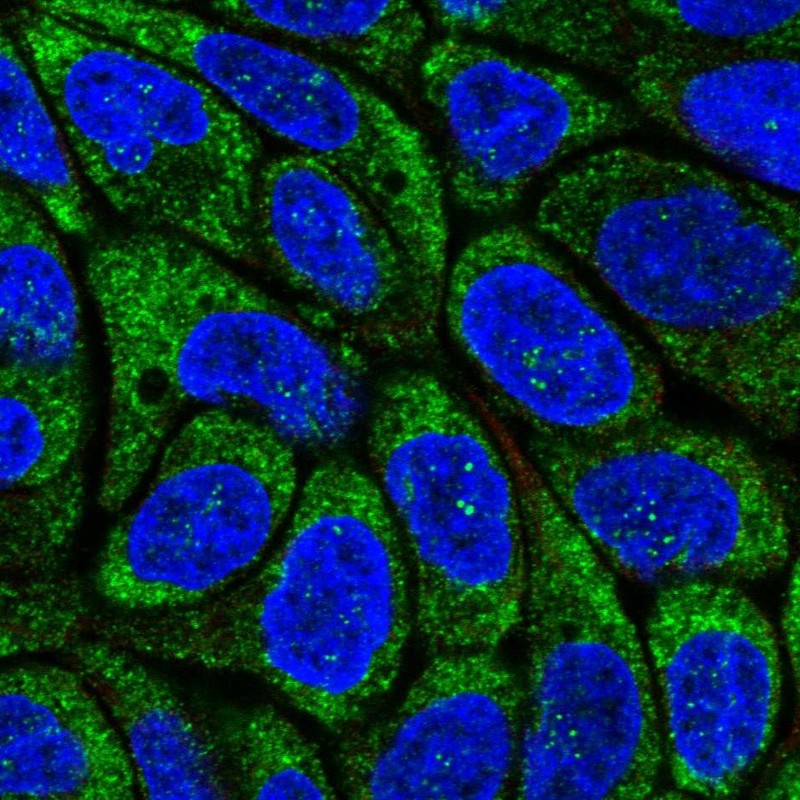 Atlas Antibodies Anti-RSAD2 Antibody