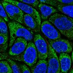 Atlas Antibodies Anti-RSAD2 Antibody