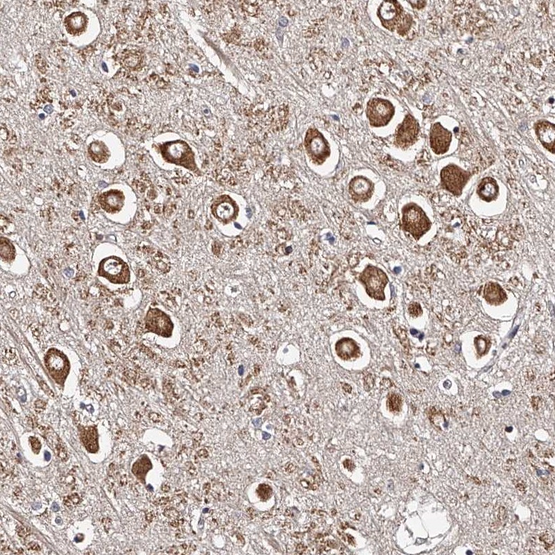 Atlas Antibodies Anti-RSC1A1 Antibody