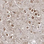 Atlas Antibodies Anti-RSC1A1 Antibody