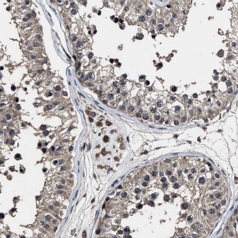 Atlas Antibodies Anti-RSBN1L Antibody