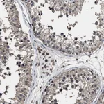 Atlas Antibodies Anti-RSBN1L Antibody
