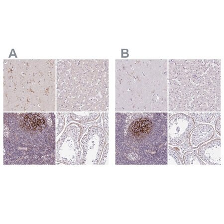 Merck Anti-TMEM119 antibody produced in rabbit