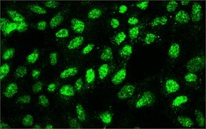 Merck MONOCLONAL ANTI-SUV39H1 HISTONE METHYLTR