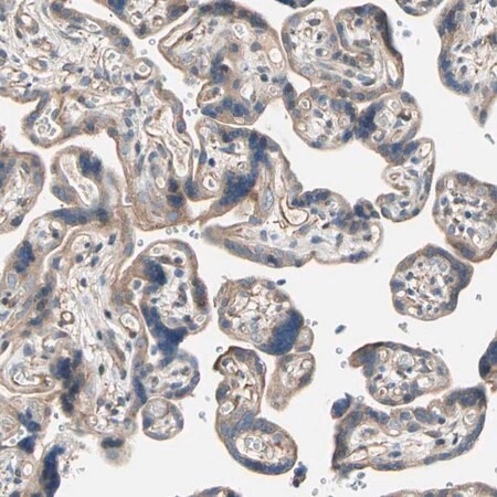 Merck Anti-LIMK2 antibody produced in rabbit