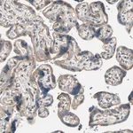 Merck Anti-LIMK2 antibody produced in rabbit