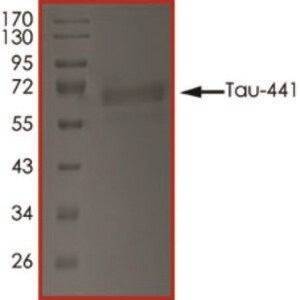 Merck TAU-441, TTBK1-PHOSPHORYLATED