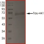 Merck TAU-441, TTBK1-PHOSPHORYLATED