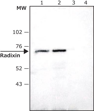 Merck Anti-Radixin antibody produced in rabbit