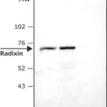 Merck Anti-Radixin antibody produced in rabbit