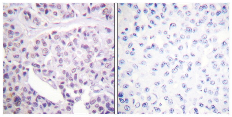 Merck Anti-p53, antibody produced in rabbit