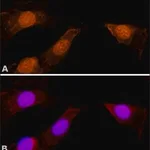 Merck ANTI-MYOSIN IBETA (NUCLEAR), DEVELOPED