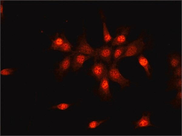 Merck Anti-SMAD6 (N-terminal) antibody produced in rabbit