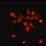 Merck Anti-SMAD6 (N-terminal) antibody produced in rabbit