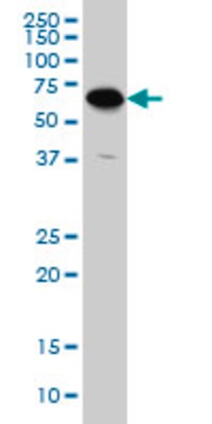 Merck MONOCLONAL ANTI-ATP6V1C2