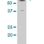 Merck MONOCLONAL ANTI-ATP6V1C2