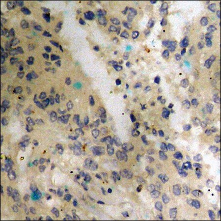 Merck Anti-phospho-p53 (pThr18) antibody produced in rabbit