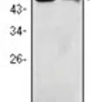 Merck MONOCLONAL ANTI-BDH1