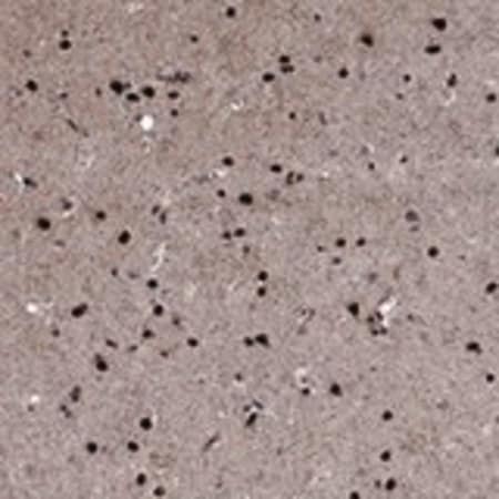 Merck Anti-PRICKLE4 antibody produced in rabbit