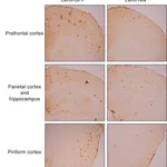 Merck MONOCLONAL ANTI-B-AMYLOID PROTEIN &