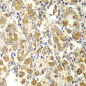Merck ANTI-TNF-? ANTIBODY PRODUCED IN RABBIT