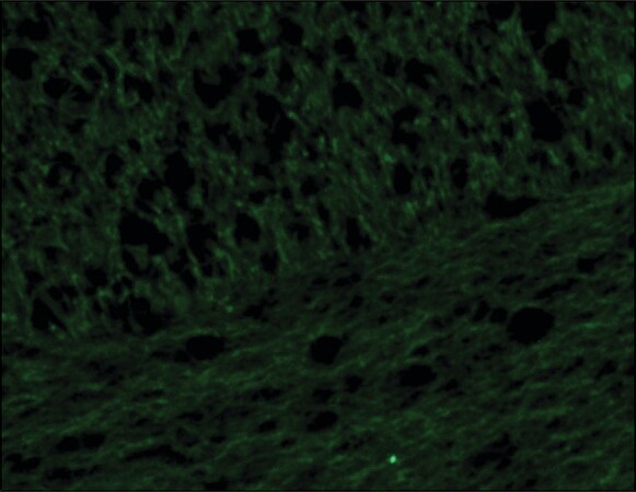 Merck Anti-Neurofilament 160 antibody, Mouse monoclonal