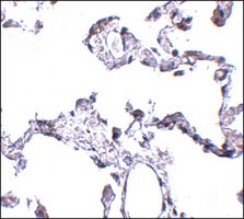 Merck ANTI-CD81