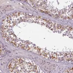 Merck Anti-PBX4 antibody produced in rabbit