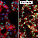 Thermo Fisher Scientific Goat anti-Rabbit IgG (H+L) Secondary Antibody, DyLight 488