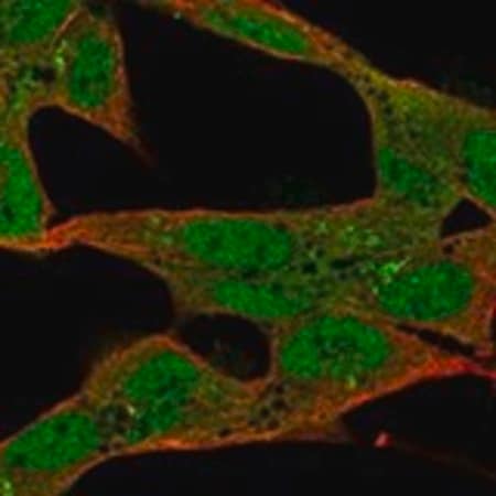Merck Anti-ST8SIA2 antibody produced in rabbit