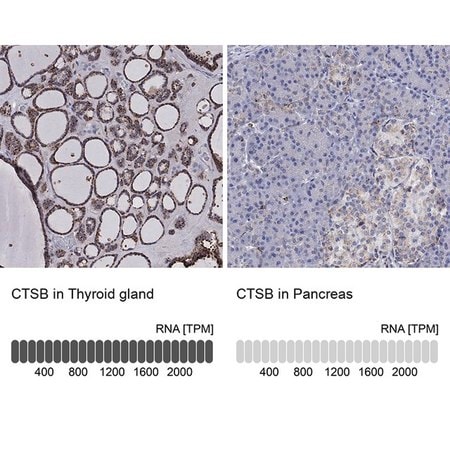 Merck Anti-CTSB antibody produced in rabbit