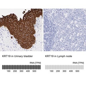 Merck ANTI-KRT19