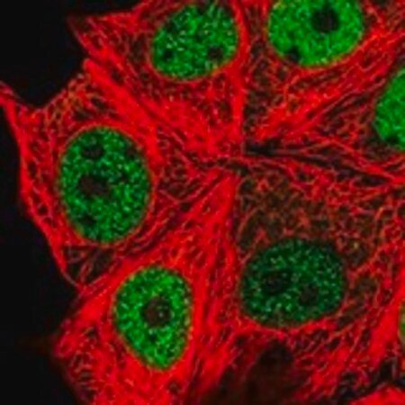 Merck Anti-SPHK2 antibody produced in rabbit