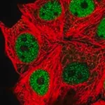Merck Anti-SPHK2 antibody produced in rabbit