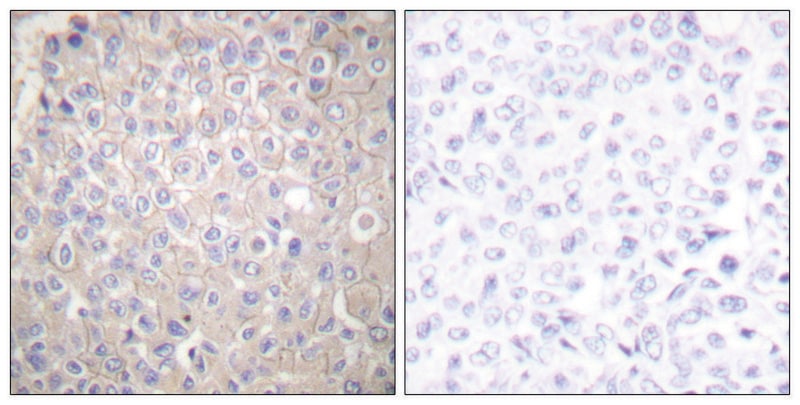 Merck Anti-E-cadherin antibody produced in rabbit