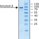 Merck Amyloid Precursor Protein beta, Secreted human