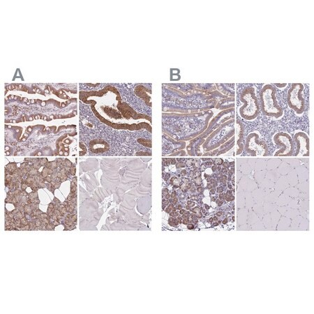 Merck Anti-TMED10 antibody produced in rabbit