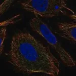 Merck Anti-TMEM9 antibody produced in rabbit