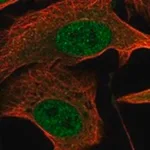 Merck Anti-CTC1 antibody produced in rabbit