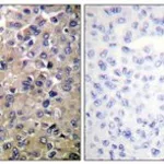 Merck ANTI-PP1-? ANTIBODY PRODUCED IN RABBIT