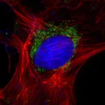 Thermo Fisher Scientific Rabbit anti-Goat IgG (Heavy Chain) Superclonal Secondary Antibody, Alexa Fluor 555