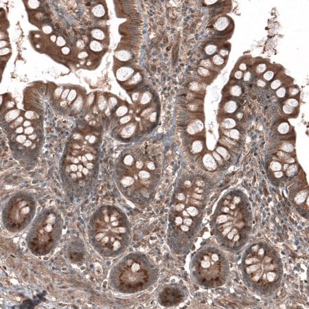 Merck Anti-HMGCR antibody produced in rabbit