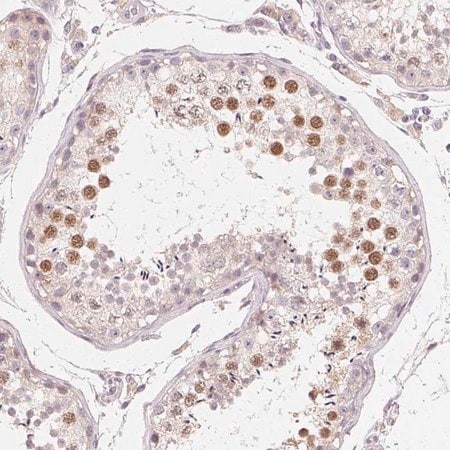 Merck Anti-MYBL1 antibody produced in rabbit