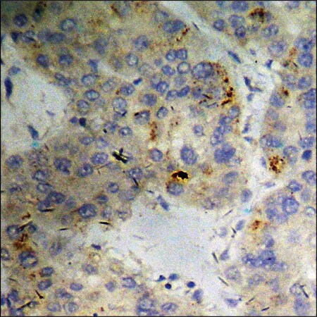 Merck Anti-phospho-PKD2 (pSer876) antibody produced in rabbit